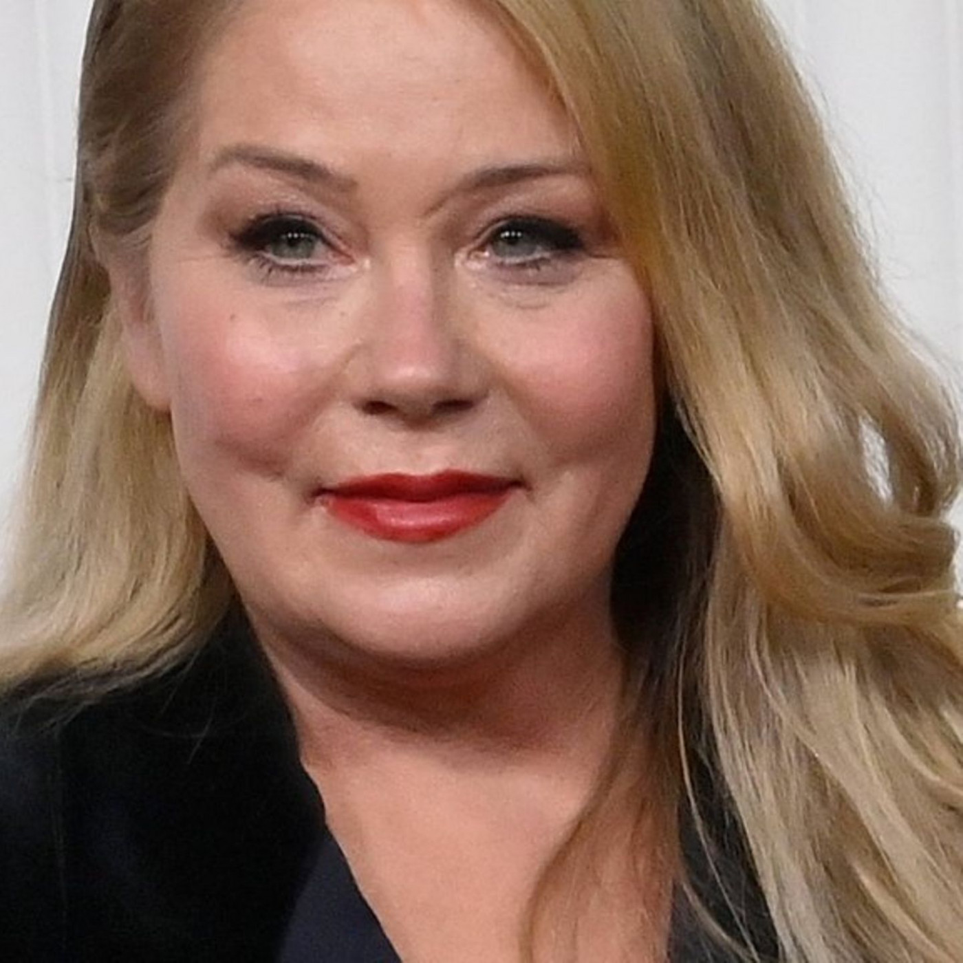 Christina Applegate über MS: "Das Schlimmste, was ich je durchgemacht habe"