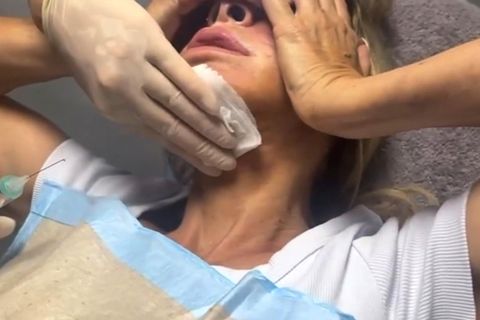 "Was hat er mir angetan?": Carmen Geiss zeigt Überfall-Verletzungen im Video