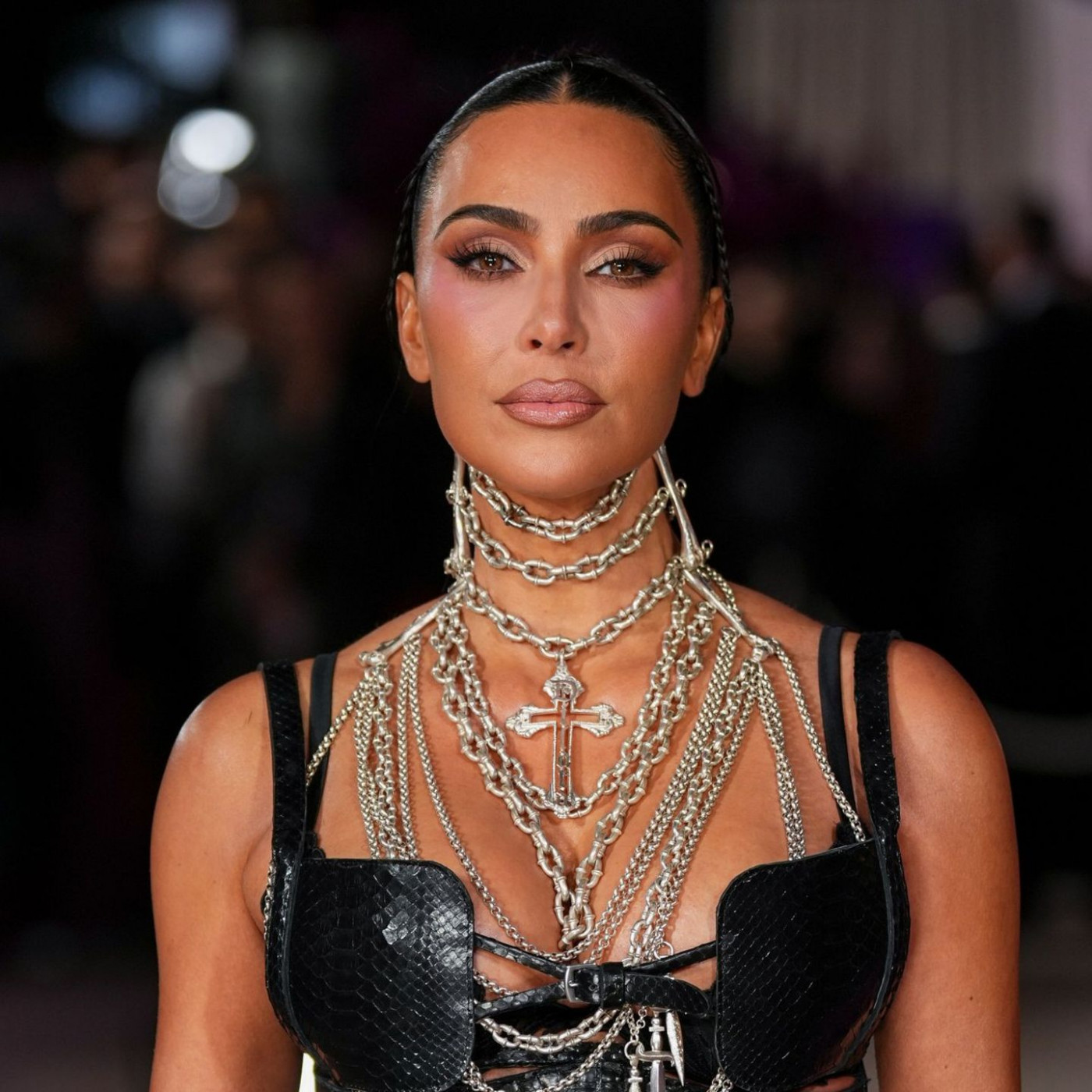 Kim Kardashian berichtet von kleinem Aneurysma im Gehirn