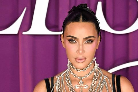 Bei Kim Kardashian wurde offenbar ein "kleines Aneurysma" entdeckt