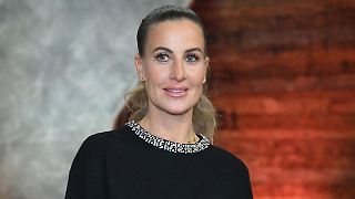 Charlotte Würdig hat Angst vor dieser Beauty-OP