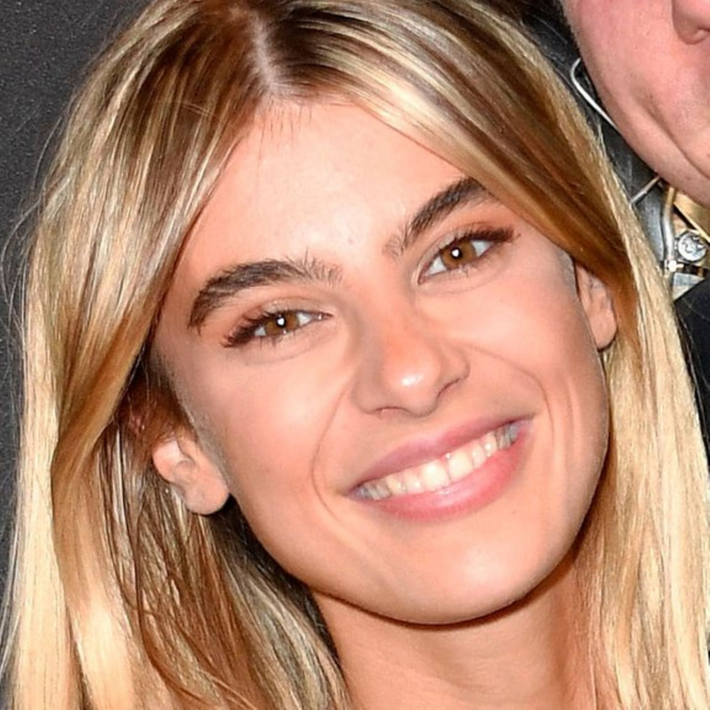 Model hat die Operation "gut &uuml;berstanden"