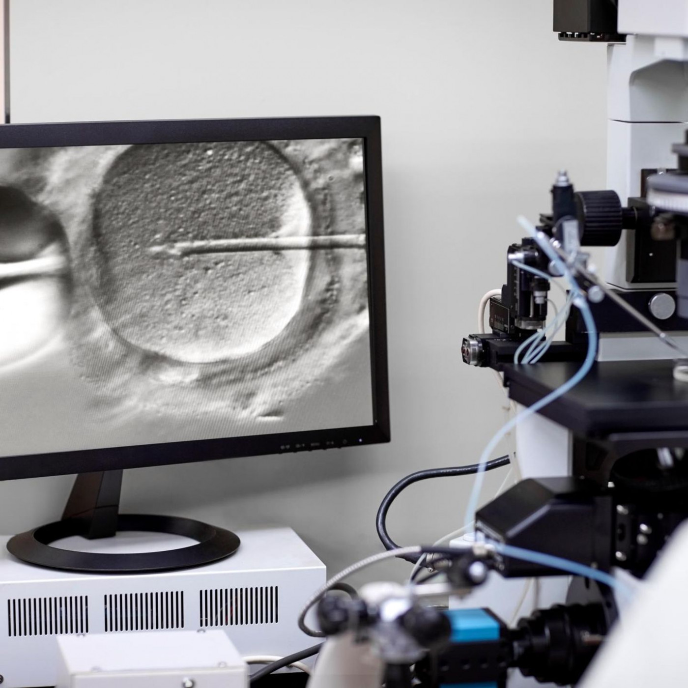 Warum Social Freezing genauso revolution&auml;r werden k&ouml;nnte wie die Pille